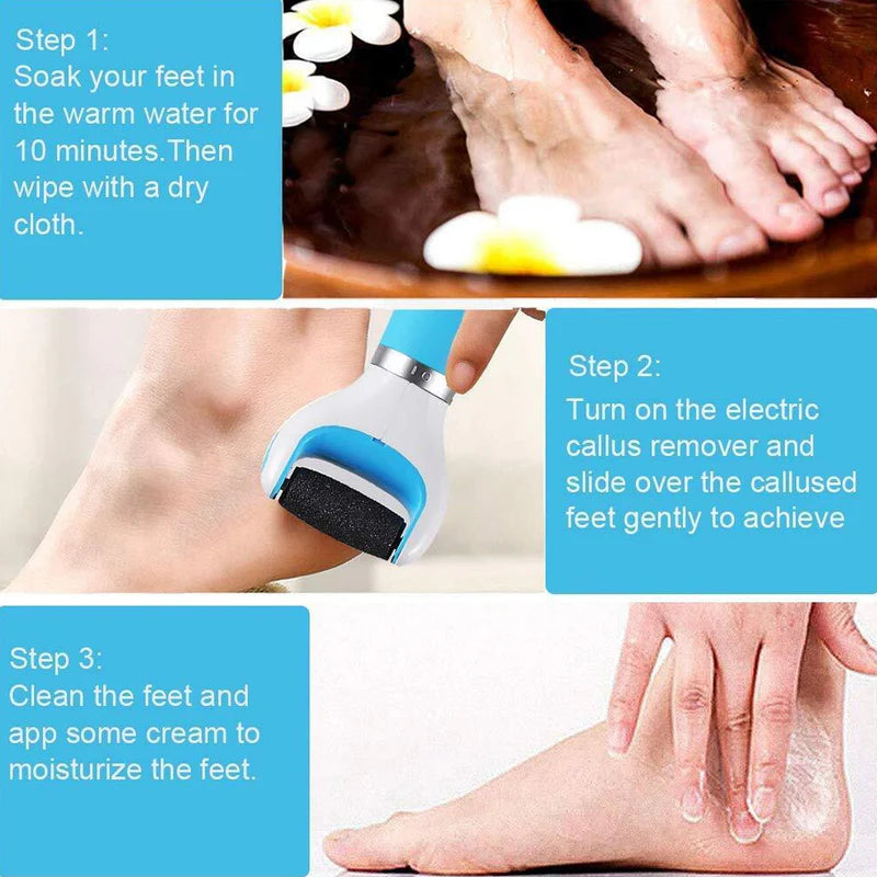 Electronic Dry Foot Callous Remover-  Regular Coarse Baby Smooth Feet In Minutes. Battery Powered /Usb (Battery Not Included)