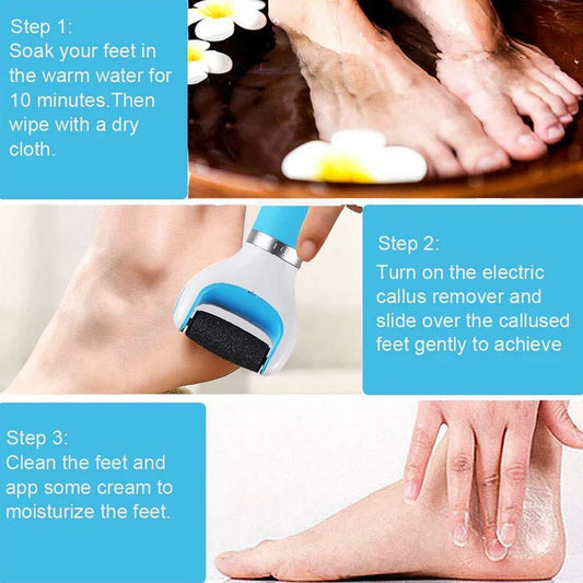 Electronic Dry Foot Callous Remover-  Regular Coarse Baby Smooth Feet In Minutes. Battery Powered /Usb (Battery Not Included)