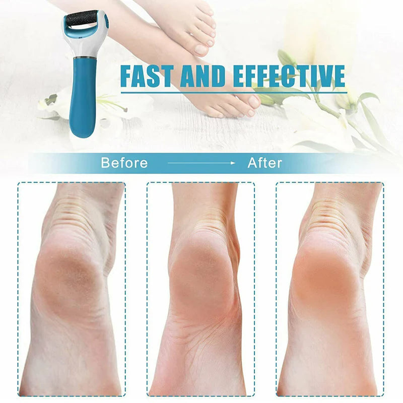 Electronic Dry Foot Callous Remover-  Regular Coarse Baby Smooth Feet In Minutes. Battery Powered /Usb (Battery Not Included)